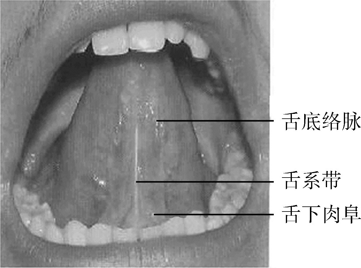 舌头红、厚、凹、凸都是病！舌红有热 舌厚有痰 舌凹有虚，舌鼓有堵 - 知乎
