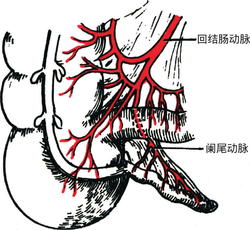 图4-30 阑尾动脉