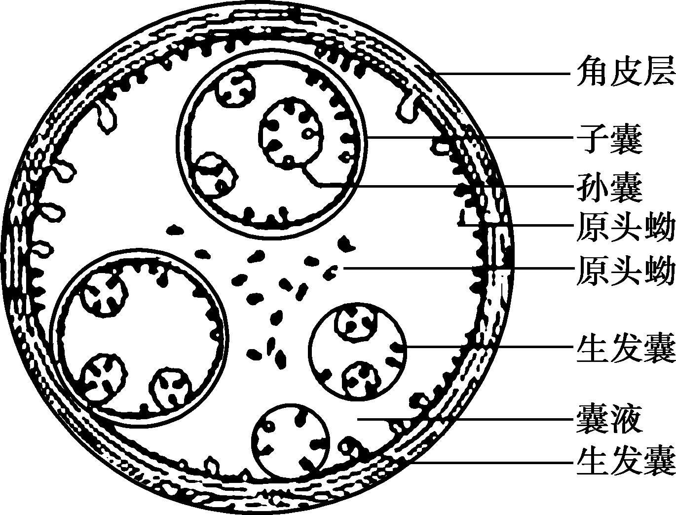 棘球蚴结构模式图