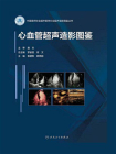 心血管超声造影图鉴[精品]