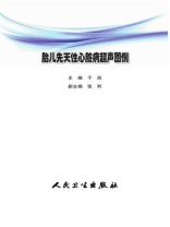 胎儿先天性心脏病超声图例