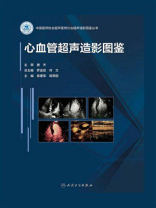 心血管超声造影图鉴
