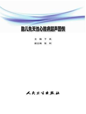 胎儿先天性心脏病超声图例